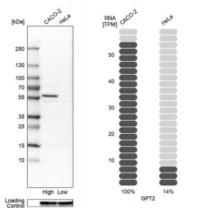 Anti-GPT2 antibody produced in rabbit 