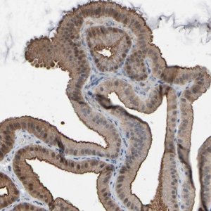 Anti-GPX2 antibody produced in rabbit 