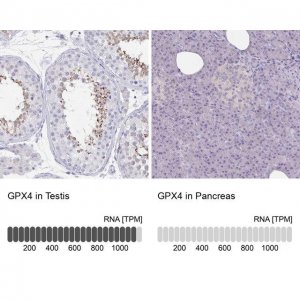Anti-GPX4 antibody produced in rabbit 