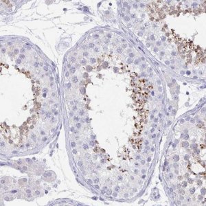 Anti-GPX4 antibody produced in rabbit 
