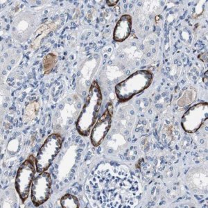 Anti-GRAMD1A antibody produced in rabbit 