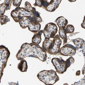 Anti-GRAMD3 antibody produced in rabbit HPA009678-100UL