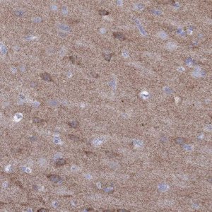 Anti-GRIA2 antibody produced in rabbit 
