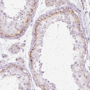 Anti-GRID2 antibody produced in rabbit 