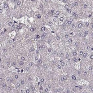 Anti-GRK1 antibody produced in rabbit 