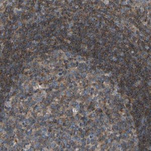 Anti-GRK6 antibody produced in rabbit 