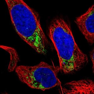 Anti-GRK6 antibody produced in rabbit 