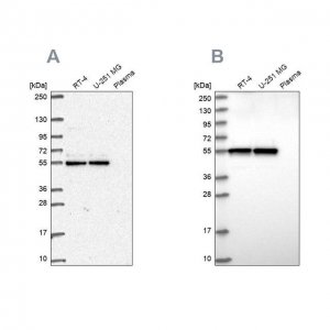 Anti-GRWD1 antibody produced in rabbit 