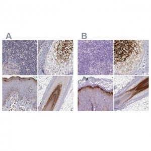 Anti-GSDMA antibody produced in rabbit 