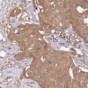 Anti-GSPT1 antibody produced in rabbit 