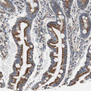 Anti-GSTK1 antibody produced in rabbit 