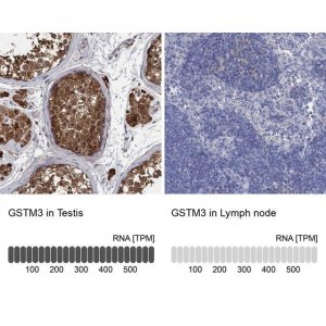 Anti-GSTM3 antibody produced in rabbit 