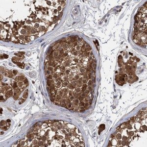 Anti-GSTM3 antibody produced in rabbit 