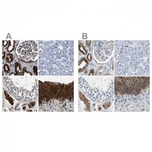 Anti-GSTP1 antibody produced in rabbit 