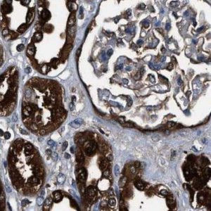 Anti-GSTP1 antibody produced in rabbit 