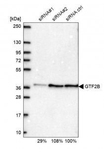 Anti-GTF2B antibody produced in rabbit 