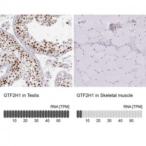 Anti-GTF2H1 antibody produced in rabbit 