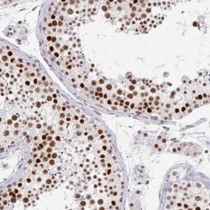 Anti-GTF2H1 antibody produced in rabbit 