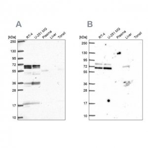 Anti-GTF3C5 antibody produced in rabbit 