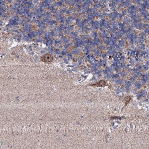 Anti-GTPBP4 antibody produced in rabbit 