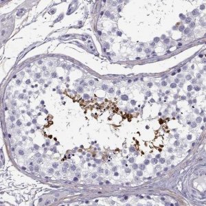 Anti-GTSF1L antibody produced in rabbit 