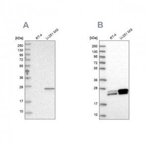 Anti-GUK1 HPA028118-100UL