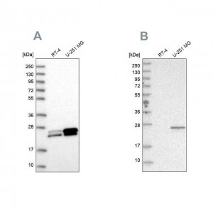 Anti-GUK1 antibody produced in rabbit 