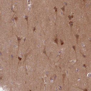 Anti-GUK1 antibody produced in rabbit 