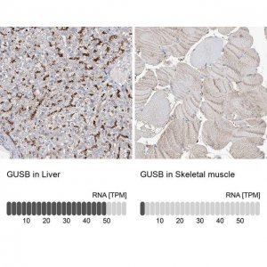 Anti-GUSB antibody produced in rabbit 