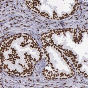 Anti-H1F0 antibody produced in rabbit HPA000843-100UL
