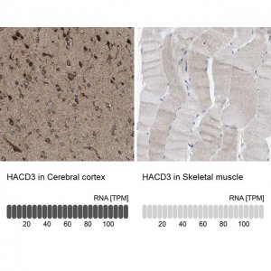 Anti-HACD3 antibody produced in rabbit HPA014837-100UL