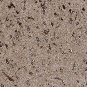 Anti-HACD3 antibody produced in rabbit HPA014837-100UL