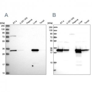Anti-HADH antibody produced in rabbit 