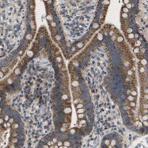 Anti-HADHA antibody produced in rabbit 