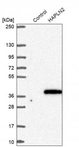 Anti-HAPLN2 antibody produced in rabbit HPA045765-100UL