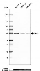 Anti-HARS antibody produced in rabbit 