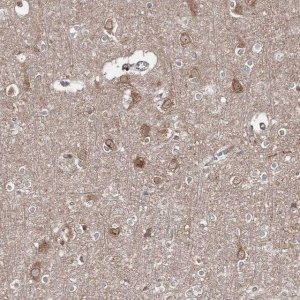 Anti-HARS antibody produced in rabbit 