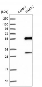 Anti-HARS2 antibody produced in rabbit HPA035941-100UL