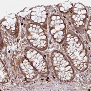 Anti-HARS2 antibody produced in rabbit HPA035941-100UL