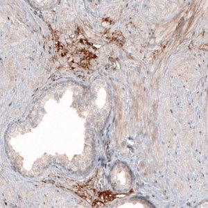 Anti-HAS3 antibody produced in rabbit 