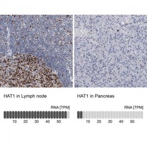 Anti-HAT1 antibody produced in rabbit 