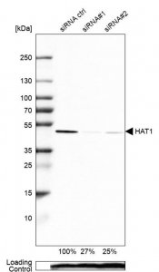 Anti-HAT1 antibody produced in rabbit 
