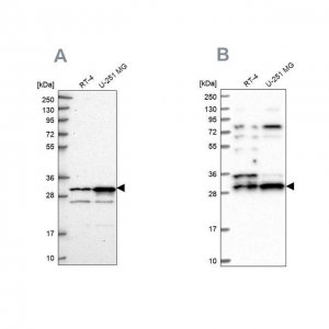 Anti-HAUS1 antibody produced in rabbit 