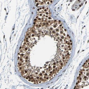 Anti-HDAC2 antibody produced in rabbit 