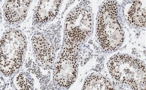 Anti-HDAC2 Antibody, clone 1E22 ZooMAb Rabbit Monoclonal 