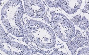 Anti-HDAC2 Antibody, clone 1E22 ZooMAb Rabbit Monoclonal 