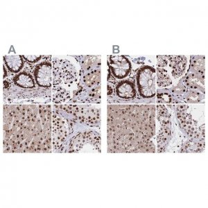 Anti-HDGF antibody produced in rabbit 