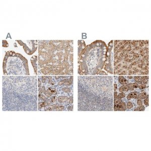 Anti-HDHD3 antibody produced in rabbit 