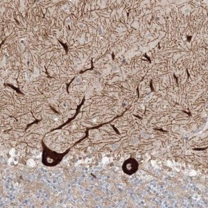 Anti-HECW2 antibody produced in rabbit 