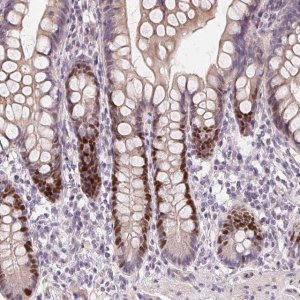 Anti-HELLS antibody produced in rabbit 